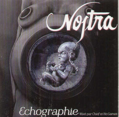 Echographie